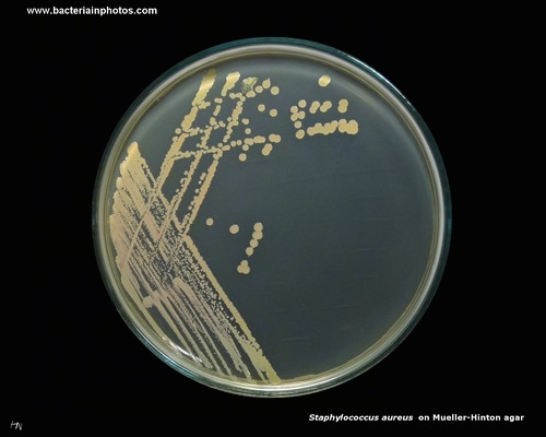 mueller hinton agar with staphylococcus
